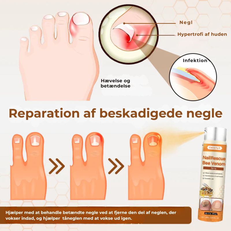 Crucial® NailRescue neglespray
