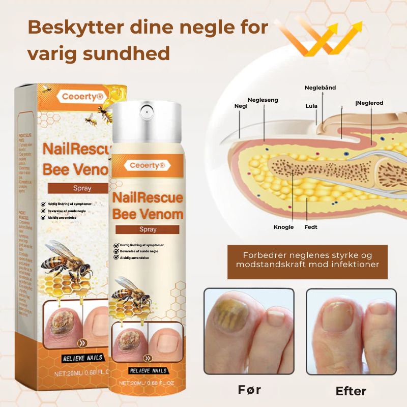Crucial® NailRescue neglespray