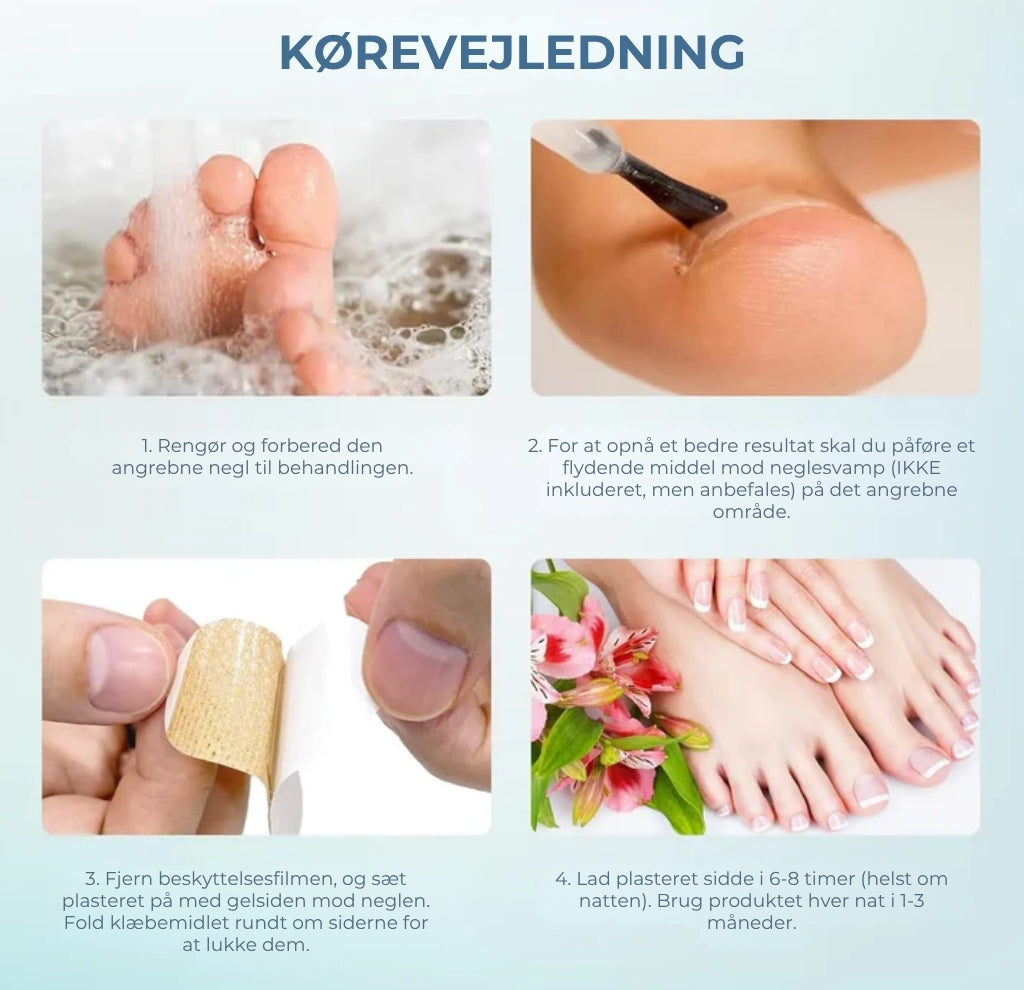 Plaster til behandling af neglesvamp – Hurtigtvirkende behandling for sunde negle