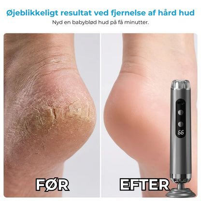 Elektrisk fodfil med 5 hastigheder