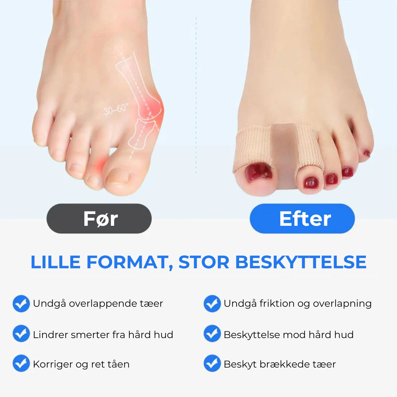 Ergonomisk tåspreder - 2 stk.