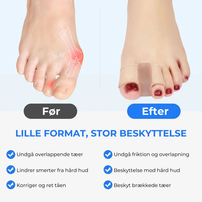 Ergonomisk tåspreder - 2 stk.